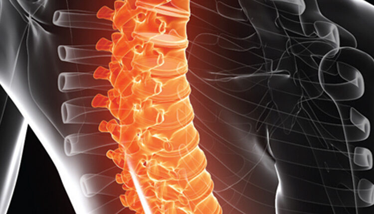 xray