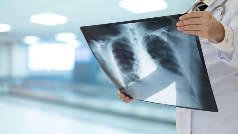 Could Better Oral Care in Hospitals Save Lives?